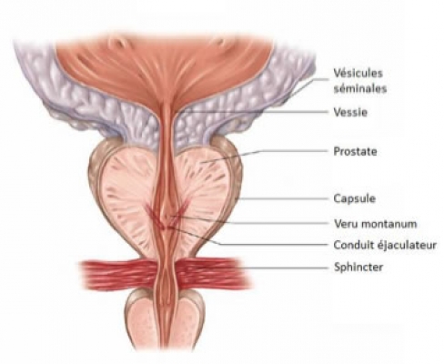 jet urinar intrerupt radiation therapy for prostate cancer